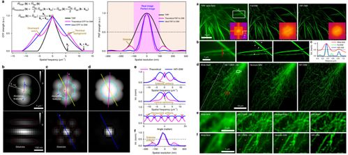 苏州医工所结构光照明超分辨显微成像技术研究取得系列进展